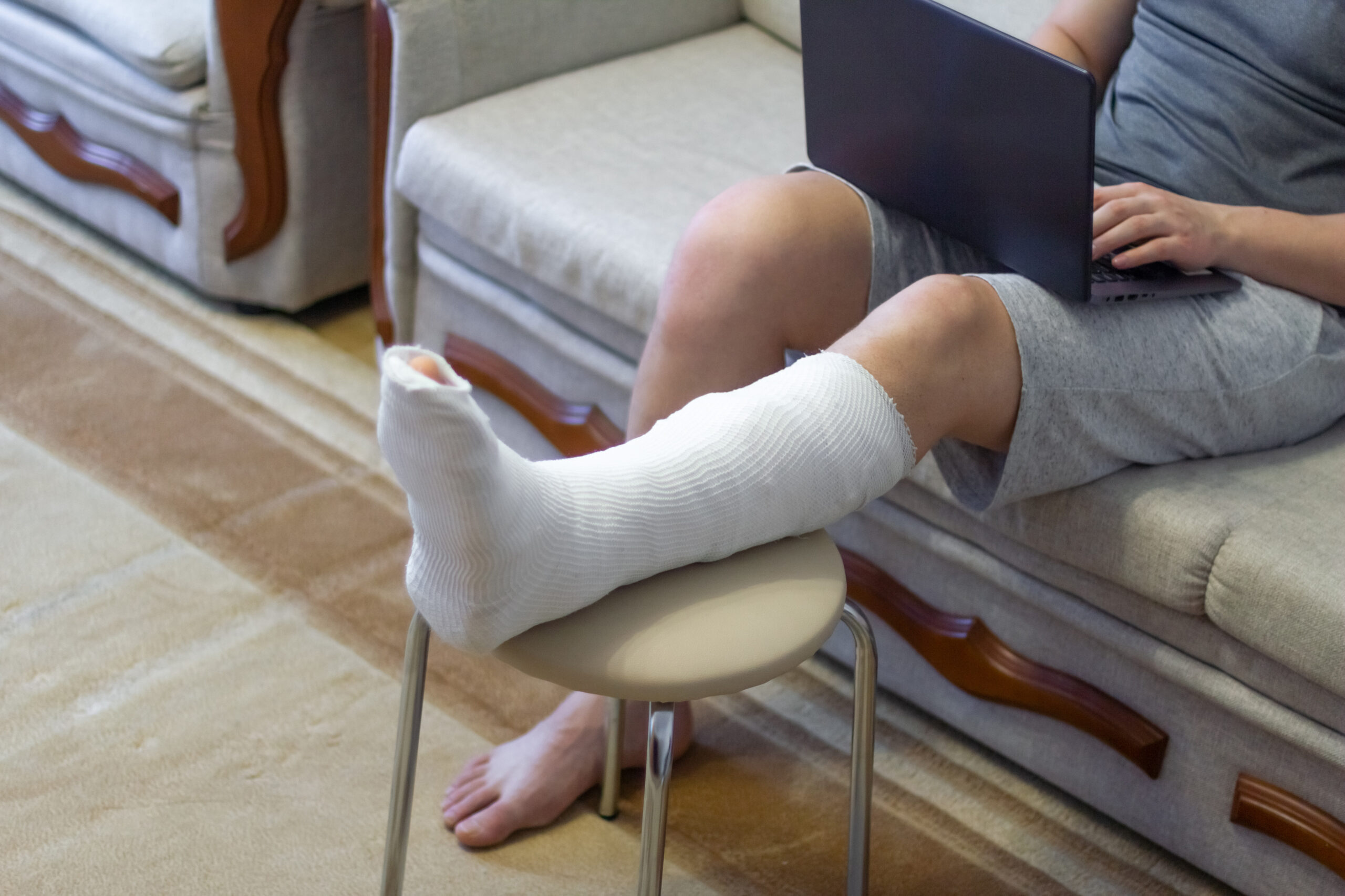 A man sits on a sofa in a cast with a laptop. A leg in a cast lies on a chair.